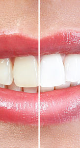 Cosmetic Dentistry Services